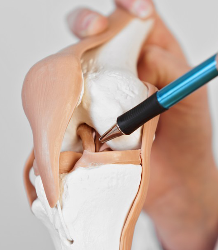 Lesões de Ligamento